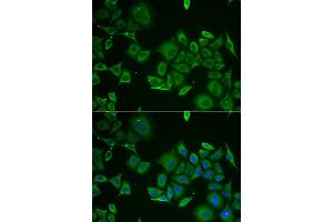 Immunofluorescence analysis of HeLa cell using C1D antibody. (C1D 抗体)