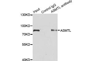 Immunoprecipitation analysis of 200 μg extracts of SW620 cells using 1 μg ASMTL antibody (ABIN5975463). (ASMTL 抗体)