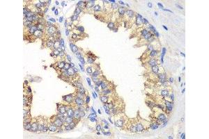 Immunohistochemistry of paraffin-embedded Human prostate using KLK10 Polyclonal Antibody at dilution of 1:100 (40x lens). (Kallikrein 10 抗体)