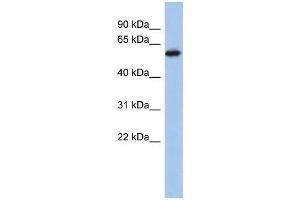 Human PANC1; WB Suggested Anti-ZNF496 Antibody Titration: 0. (ZNF496 抗体  (Middle Region))