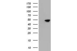 Western Blotting (WB) image for anti-5'-Nucleotidase Domain Containing 1 (NT5DC1) antibody (ABIN1499840) (NT5DC1 抗体)