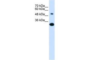 Western Blotting (WB) image for anti-Solute Carrier Family 2 (Facilitated Glucose/fructose Transporter), Member 5 (SLC2A5) antibody (ABIN2462527) (SLC2A5 抗体)