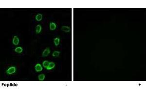 Immunofluorescence analysis of A-549 cells, using ATP5G3 polyclonal antibody . (ATP5G3 抗体)
