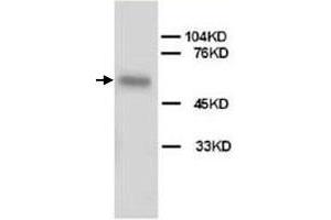 Western Blot analysis of ALPL expression from HeLa cell lyate with ALPL polyclonal antibody . (ALPL 抗体  (N-Term))