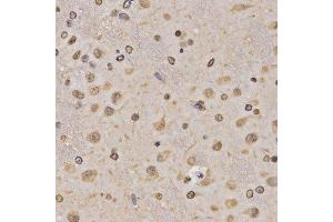 Immunohistochemistry of paraffin-embedded rat brain using MonoMethyl-Histone H3-K36 antibody. (Histone 3 抗体  (H3K36me))