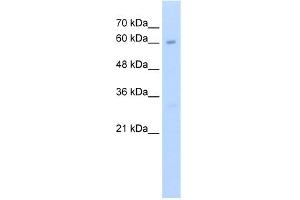 WB Suggested Anti-KIAA0859 Antibody Titration:  2. (METTL13 抗体  (C-Term))