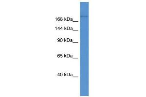 WB Suggested Anti-Abca1 Antibody Titration:  0. (ABCA1 抗体  (Middle Region))
