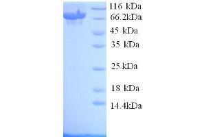 SDS-PAGE (SDS) image for Toll-Like Receptor 8 (TLR8) (AA 27-827) protein (His tag) (ABIN5713898)