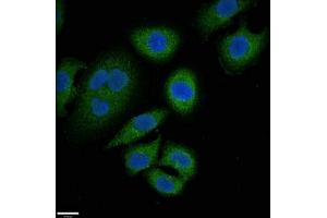 Immunofluorescent analysis of A549 cells using ABIN7144908 at dilution of 1:100 and Alexa Fluor 488-congugated AffiniPure Goat Anti-Rabbit IgG(H+L) (ABCC9 抗体  (AA 560-669))