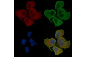 ABIN6260022 and ABIN6276440 staining Hela cells(30 min of UV treatment) by IF/ICC. (ARF6 抗体  (Internal Region))
