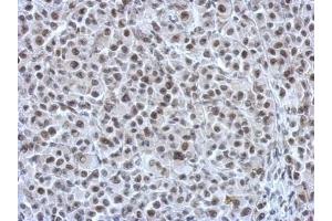 IHC-P Image Immunohistochemical analysis of paraffin-embedded HBL435 xenograft, using RAD21, antibody at 1:750 dilution. (RAD21 抗体  (Center))