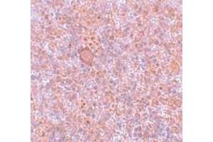 Immunohistochemistry (IHC) image for anti-Retinoblastoma Binding Protein 8 (RBBP8) (Middle Region) antibody (ABIN1031055) (Retinoblastoma Binding Protein 8 抗体  (Middle Region))