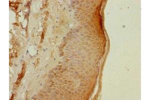 Immunohistochemistry of paraffin-embedded human skin tissue using ABIN7164977 at dilution of 1:100 (PSMB3 抗体  (AA 1-205))