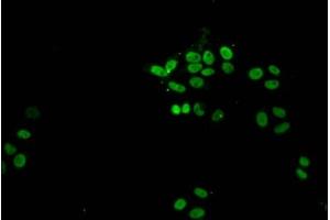 Immunofluorescent analysis of HepG2 cells (sodium butyrate, 30 mM, 4h) using ABIN7139172 at dilution of 1:100 and Alexa Fluor 488-congugated AffiniPure Goat Anti-Rabbit IgG(H+L) (Histone H1.1 抗体  (acLys21))