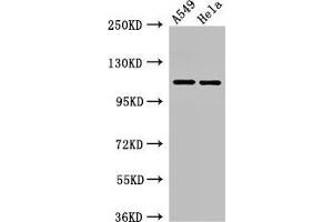 Western Blot Positive WB detected in: A549 whole cell lysate, Hela whole cell lysate All lanes: EPHA5 antibody at 3 μg/mL Secondary Goat polyclonal to rabbit IgG at 1/50000 dilution Predicted band size: 115, 113, 108 kDa Observed band size: 115 kDa (EPH Receptor A5 抗体  (AA 246-514))