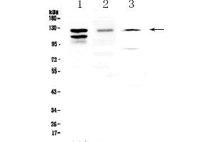 Western blot analysis of VE Cadherin using anti-VE Cadherin antibody . (Cadherin 5 抗体  (AA 46-285))