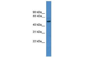 WB Suggested Anti-ZNF277  Antibody Titration: 0. (ZNF277 抗体  (N-Term))
