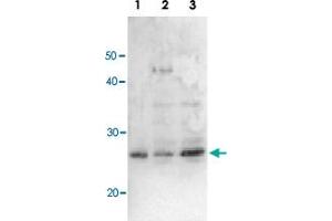 Detection of RuvA (22kD) protein by Western blotting using this antibody. (RuvA 抗体)