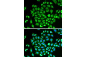 Immunofluorescence analysis of HeLa cells using AKR7A2 antibody. (AKR7A2 抗体  (AA 100-359))