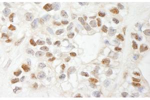Immunohistochemistry (IHC) image for anti-Chemokine (C-C Motif) Ligand 2 (CCL2) (AA 25-100) antibody (ABIN7449398) (CCL2 抗体  (AA 25-100))