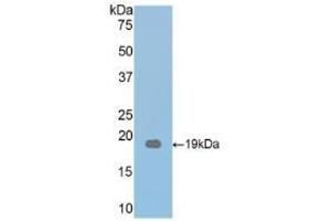 Detection of Recombinant THBS1, Mouse using Polyclonal Antibody to Thrombospondin 1 (THBS1) (Thrombospondin 1 抗体  (AA 515-671))