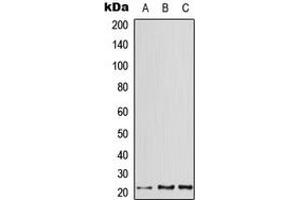 Western blot analysis of ATF3 expression in HeLa (A), mouse heart (B), rat heart (C) whole cell lysates. (ATF3 抗体  (C-Term))