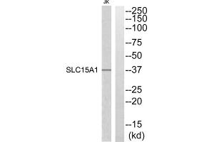 Western blot analysis of extracts from Jurkat cells, using SLC15A1 antibody. (SLC15A1 抗体  (Internal Region))