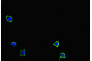 Immunofluorescent analysis of HepG2 cells using ABIN7149644 at dilution of 1:100 and Alexa Fluor 488-congugated AffiniPure Goat Anti-Rabbit IgG(H+L) (GRID2IP 抗体  (AA 35-156))