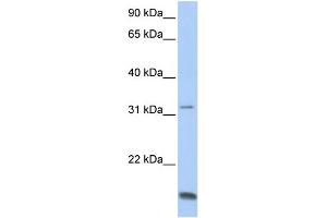 WB Suggested Anti-TCAP Antibody Titration:  0. (TCAP 抗体  (N-Term))