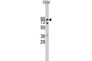 Western blot analysis of CDH10 polyclonal antibody  in CEM cell line lysates (35 ug/lane). (CDH10 抗体  (N-Term))