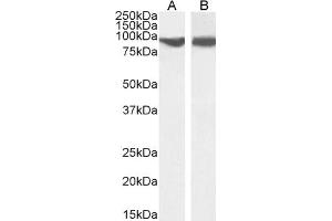 Western Blotting (WB) image for anti-Vacuolar Protein Sorting 35 (VPS35) (C-Term) antibody (ABIN185182)