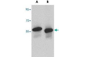 Western blot analysis of SKA3 in human testis tissue lysate with SKA3 polyclonal antibody  at (A) 0. (SKA3 抗体  (C-Term))