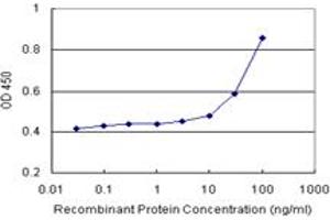 Sandwich ELISA detection sensitivity ranging from 10 ng/mL to 100 ng/mL. (ALDH1A1 (人) Matched Antibody Pair)