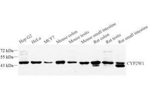 Western blot analysis of CYPIW1 (ABIN7073674) at dilution of 1: 1000 (CYP2W1 抗体)