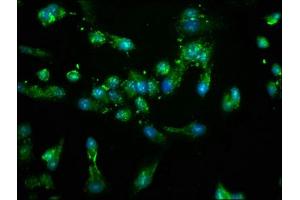 Immunofluorescence staining of Hela cells with ABIN7169102 at 1:100, counter-stained with DAPI. (NEK4 抗体  (AA 516-661))