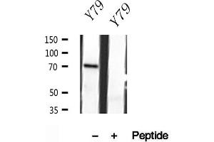 Western blot analysis of extracts of Y79 cells, using MPP5 antibody. (MPP5 抗体  (C-Term))