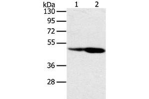Western Blot analysis of Hepg2 and hela cell using SNX8 Polyclonal Antibody at dilution of 1:400 (SNX8 抗体)