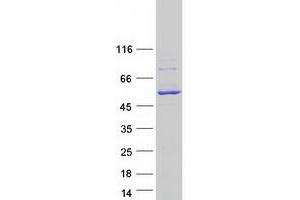 Validation with Western Blot (CYP2C18 Protein (Transcript Variant 1) (Myc-DYKDDDDK Tag))