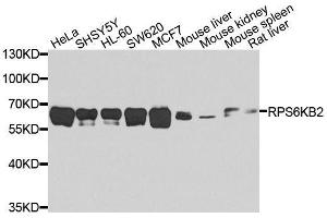 Western blot analysis of extracts of various cell lines, using RPS6KB2 antibody. (RPS6KB2 抗体  (AA 1-170))