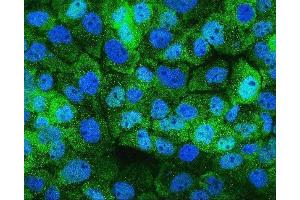 IF analysis of HSPH1 using anti-HSPH1 antibody (ABIN7602237).