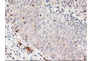 Image no. 1 for anti-LSM1 Homolog, U6 Small Nuclear RNA Associated (LSM1) antibody (ABIN1499210) (LSM1 抗体)