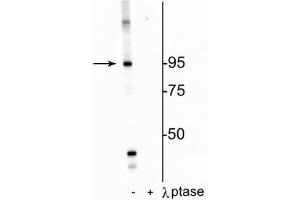 Western blot of HeLa cell lysate showing specific labeling of the ~95 kDa IR protein phosphorylated at Thr1160 in the first lane (-). (Insulin Receptor 抗体  (pThr1160))