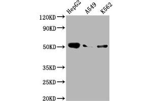 Western Blot Positive WB detected in: HepG2 whole cell lysate, A549 whole cell lysate, K562 whole cell lysate All lanes: Factor IX antibody at 1:2000 Secondary Goat polyclonal to rabbit IgG at 1/50000 dilution Predicted band size: 52 kDa Observed band size: 52 kDa (Recombinant Coagulation Factor IX 抗体)