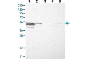 Western blot analysis of Lane 1: RT-4, Lane 2: U-251 MG, Lane 3: Human Plasma, Lane 4: Liver, Lane 5: Tonsil with TRIM11 polyclonal antibody  at 1:250-1:500 dilution. (TRIM11 抗体)