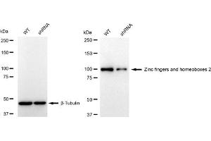 Western blotting analysis using Zinc fingers and homeoboxes 2 antibody (ABIN7800905). (Recombinant ZHX2 抗体)