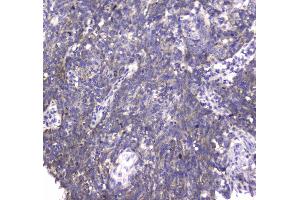 IHC analysis of MRE11 using anti-MRE11 antibody . (Mre11 抗体  (AA 2-239))