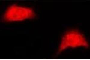Immunofluorescent analysis of UBE2Z staining in HepG2 cells. (UBE2Z 抗体)