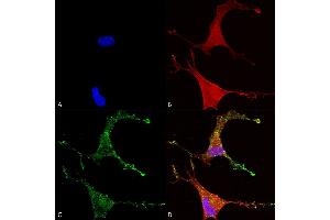 Immunocytochemistry/Immunofluorescence analysis using Mouse Anti-Cav beta 2 Monoclonal Antibody, Clone S8B-1 (ABIN2485029). (CACNB2 抗体  (AA 189-205) (Atto 488))