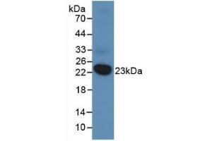 Western blot analysis of recombinant Human DUSP3. (Dual Specificity Phosphatase 3 (DUSP3) (AA 2-185) 抗体)