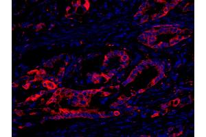 anti-Eukaryotic Elongation Factor-2 Kinase (EEF2K) (AA 675-725) antibody